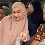 Ria Ricis Akhirnya Jujur, Alasan Medis Di Balik Oplas Hidung