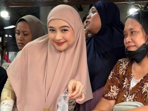 Ria Ricis Akhirnya Jujur, Alasan Medis Di Balik Oplas Hidung