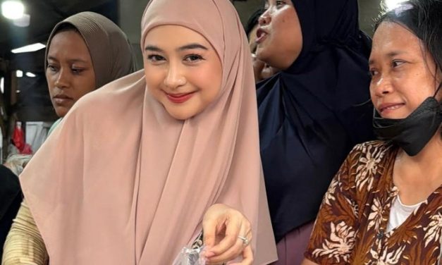 Ria Ricis Akhirnya Jujur, Alasan Medis Di Balik Oplas Hidung